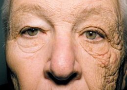 Radiación solar. Envejecimiento